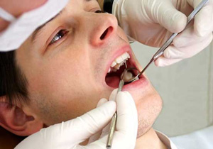 دندان‌های خود را بدون نیاز به دنداپزشک پرکنید