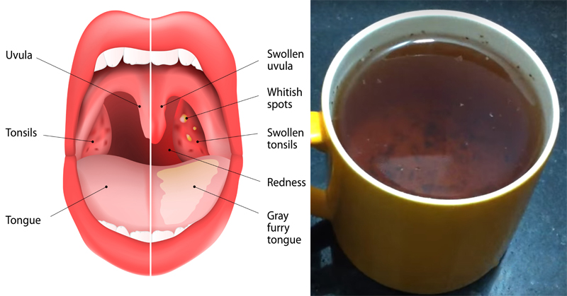 این چای درمان سریع گلو درد، آنفولانزا و عفونت سینوسی است