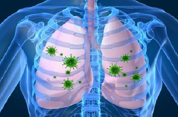 راهکارهای پیشگیری از عفونت های تنفسی را بدانیم