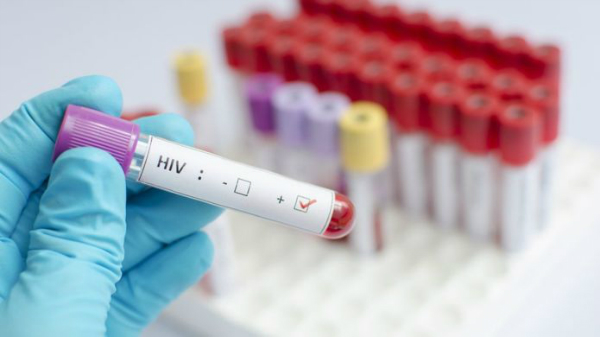 آزمایش موفقیت آمیز واکسن جدید ایدز روی انسان